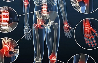 Soğuk havalarda romatizmal hastalıklar artıyor!