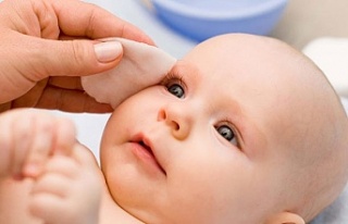 Bebeklerde göz sulanması