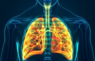 Kan testi ile akciğer kanseri teşhisi