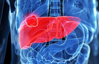 Karaciğer kanseri nasıl oluşur?